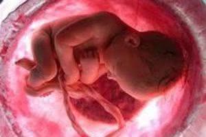 Com relação ao aborto, qual a sua opinião? (Resultado da enquete)